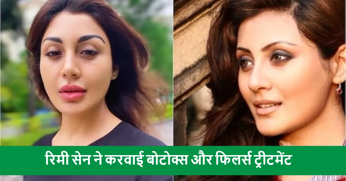 Rimi Sen Plastic Surgery News